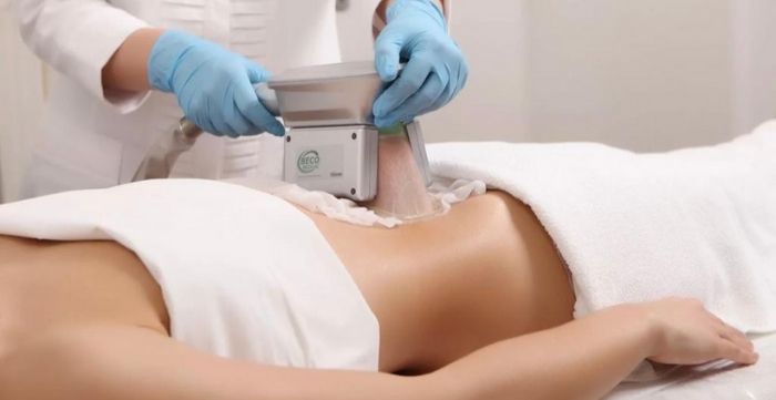 Fat Freeze Cryolipolysis