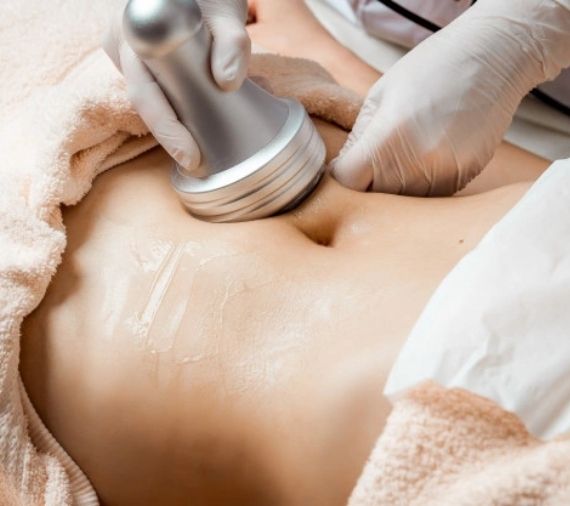 Ultrasonic Cavitation Tampa